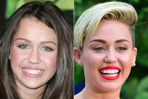 are miley cyrus' teeth fake